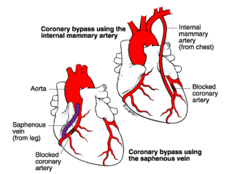 Screen shot 2017-04-26 at 3.13.21 PM